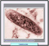 Microfotografa del bacilo de la tuberculosis