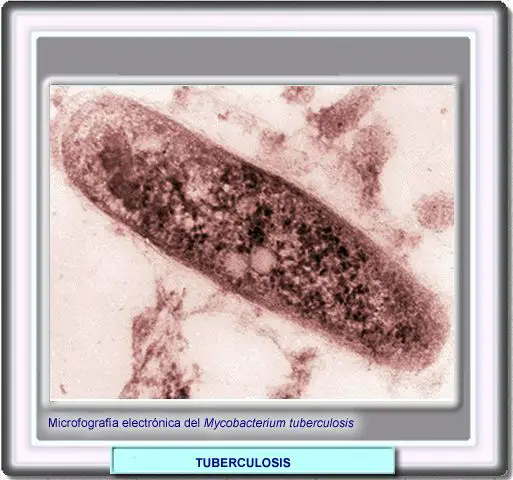 Microfotograf�a del bacilo de la tuberculosis