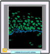 Inmunofluorescencia en la epidermolisis juntural