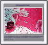 Microfotografía de osteoclastos